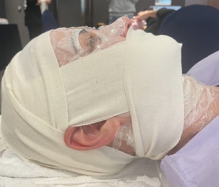 「バンテージ超小顔術」のご案内